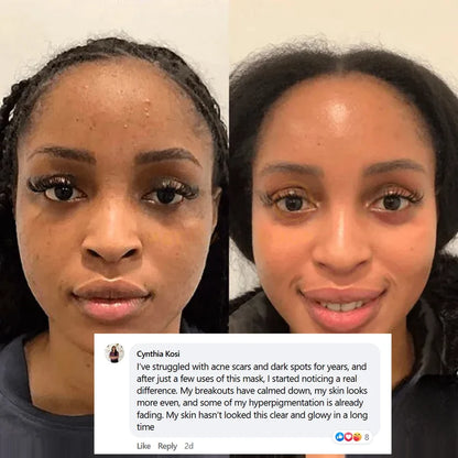 Collagen Peel Off Facial Mask
